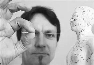 中医针刺视频,视频解析针刺技巧与疗效