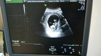 做nt视频,创意内容制作全解析