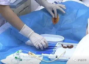 女患者导尿术操作视频,女性患者导尿术操作视频详解